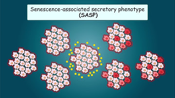 A New Paradigm for Type 1 Diabetes