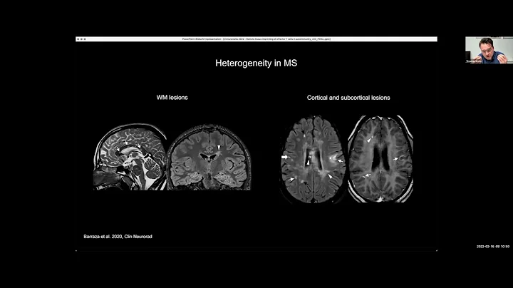 Tissue imprinting of autoreactive T cells by Dr. T...