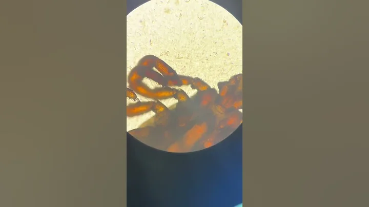 Under the microscope: Parasitic arachnid “Tick” #shorts