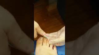 足の爪切り