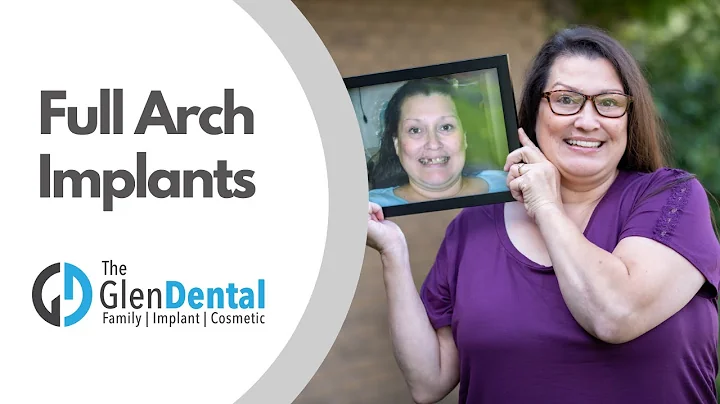 With Dental Implants I Don't Have To Clean Take Ou...