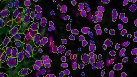 DeepCSeg: Deep learning cell segmentation