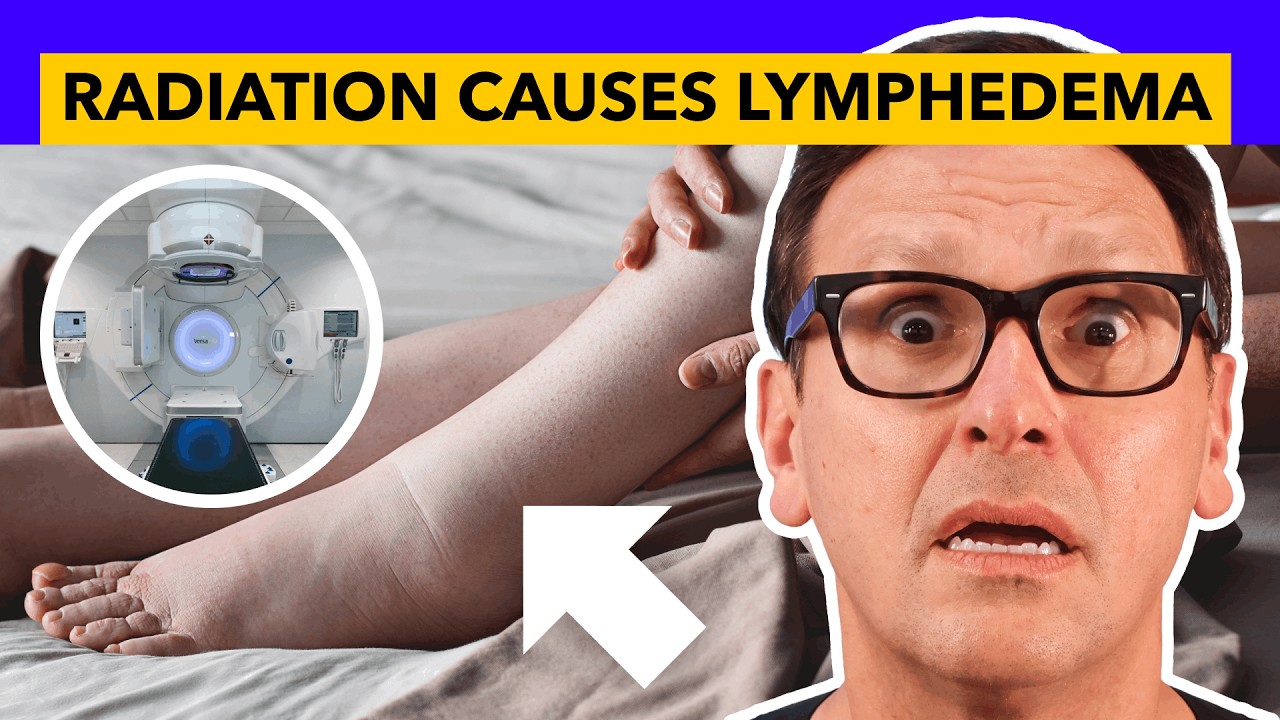 Why Your Limbs Swell Months After Finishing Radiation