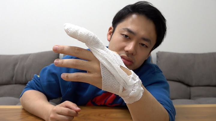 指が取れました。
