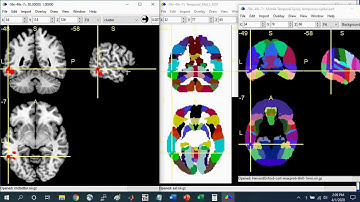 MRIcron Brain Region of Interest (ROI) Guide Part 1