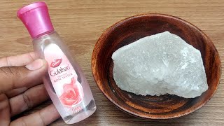 A very simple way to get rid of old spots, acne and pimples from the first use // Acne treatment