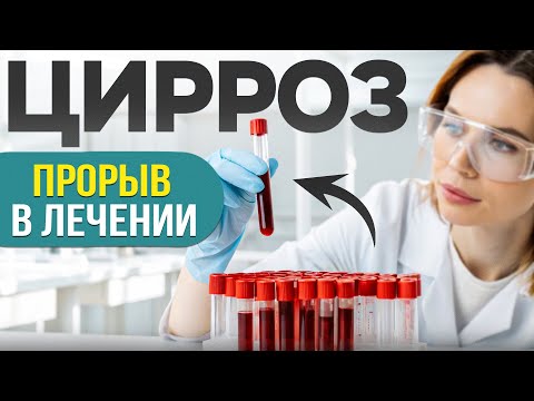 Цирроз печени. Современные методы лечения. Как не нужно лечить Цирроз? Столовые клетки и лекарства.