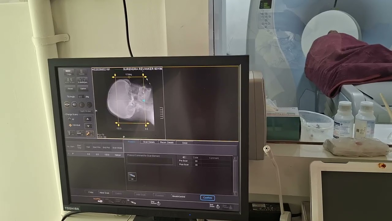 How to do CtT PNS in Toshiba 16 slice...
