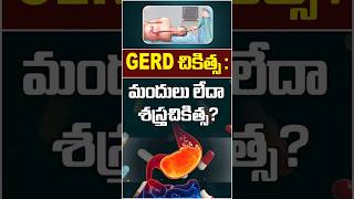 Acid Production in the Stomach | GERD | #ytshorts #healthtips #gerd #stomachproblem #acidreflux