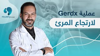 عملية Gerdx لعلاج ارتجاع المرئ | دكتور حمدي الزعيري