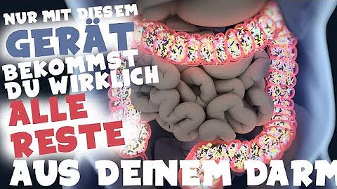 Wie bekommt man Kotsteine aus dem Darm?