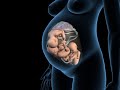 Types of triplets pregnancy  monochorionic monoamniotic triplets  3d anatomical visualization