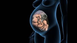 Types of triplets pregnancy - Monochorionic monoamniotic triplets - 3D Anatomical Visualization