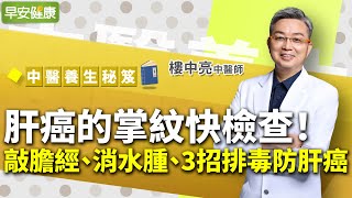 肝癌的掌紋快檢查！中醫博士教你敲膽經、消水腫、3招排毒防肝癌︱ 樓中亮 中醫師 【早安健康】