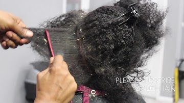 Picking BIG scalp flakes Psoriasis and Dermatitis SEW IN WEAVE REMOVAL