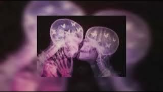 Counting stars Speed Up