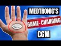 Introducing the revolutionary new cgm by medtronic  medtronic simplera