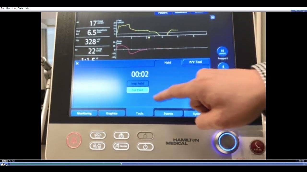 Hamilton G5 Measuring P0.1, Pocc, and DeltaP YouTube