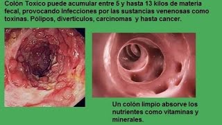 CON UN COLON SUCIO UN CUERPO ENFERMO