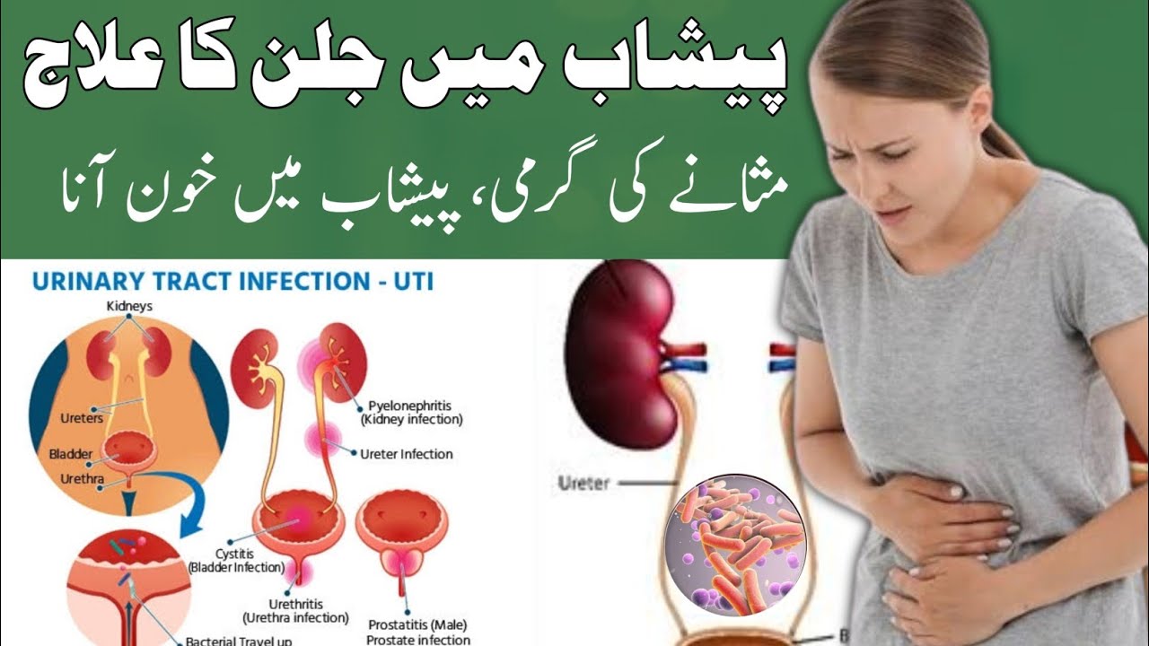 Dr. Saify: The Truth About UTI Treatment in Urdu | uti symptoms