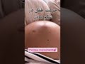 حرکت جنین طفل در شکم مادر Baby Movement بارداری