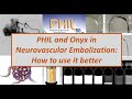 [NI Technique] PHIL and Onyx for neurovascular embolization (Brain AVM and Dural AVF)