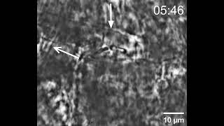 Noninvasive interception of circulating leukocyte in vivo by optical tweezer array - Supp. Video 1
