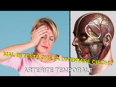 Video: I temporali possono causare mal di testa?