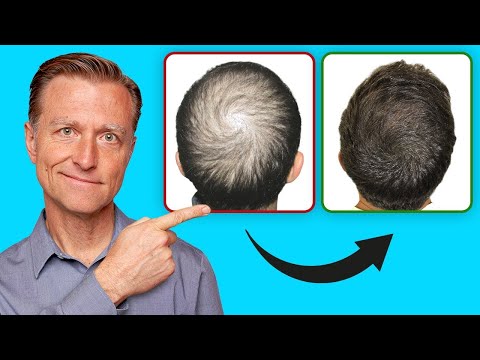How to Regrow Your Hair (UPDATED VITAL INFO)