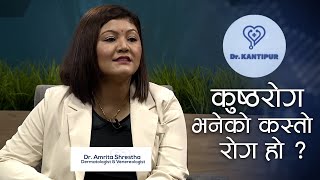 कुष्ठरोग भनेको कस्तो रोग हो ??? | Dr. Kantipur Clip