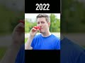 Kazoo kid before then after.. 😔