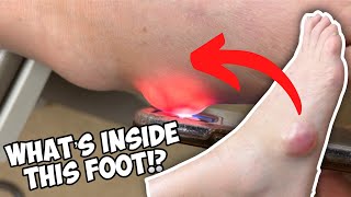 Look what was in this foot?! 😱 Dr. Nick Campitelli