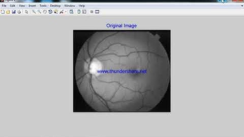 Eye Optic Disk Location Detection