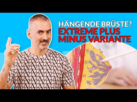 Dein Plastic Surgery Coach: Hängende Brüste nach Gewichtsverlust? Die Plus-Minus-Variante hilft!