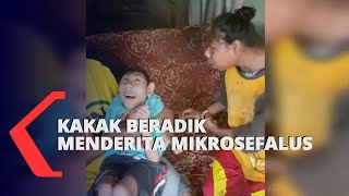 Kasihan! Kakak Beradik dari Keluarga Kurang Mampu Menderita Mikrosefalus