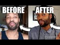 Patchy Beard? No Problem! Part 1| How to Make a Patchy Beard Full | Re-grow Hair Naturally