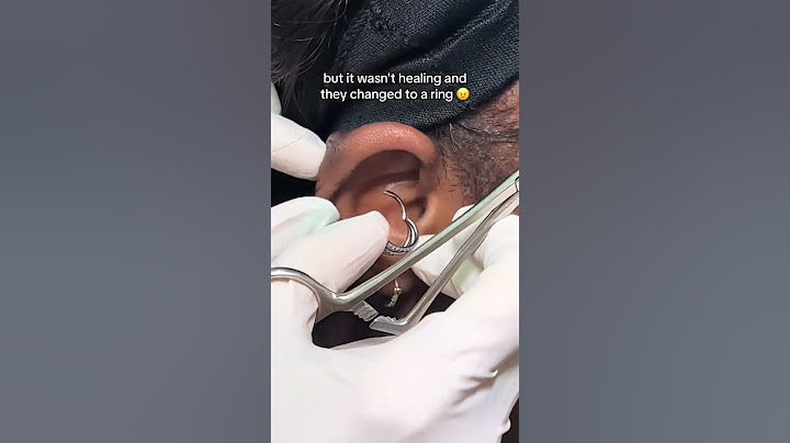 Is your piercing taking too long to heal? I have the solution for you #baselaboratories ✨