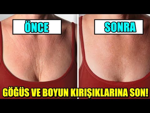 Video: Dekolte Bölgesinde Kırışıklıkları önlemenin Yolları Açıklandı