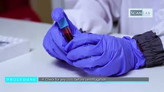 PREPARATION OF PLATELET POOR PLASMA PPP