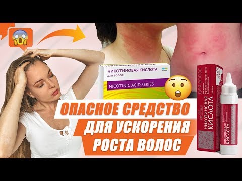 ОПАСНОЕ СРЕДСТВО ДЛЯ УСКОРЕНИЯ РОСТА ВОЛОС - НИКОТИНОВАЯ КИСЛОТА ОТЗЫВЫ