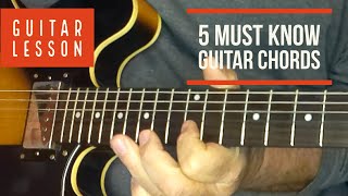 5 Must Know Guitar Chords for the Absolute Beginner Guitarist Lesson ...