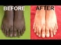 HOW TO REMOVE SUN TAN FROM FEET🌞 ~ FEET WHITENING PEDICURE