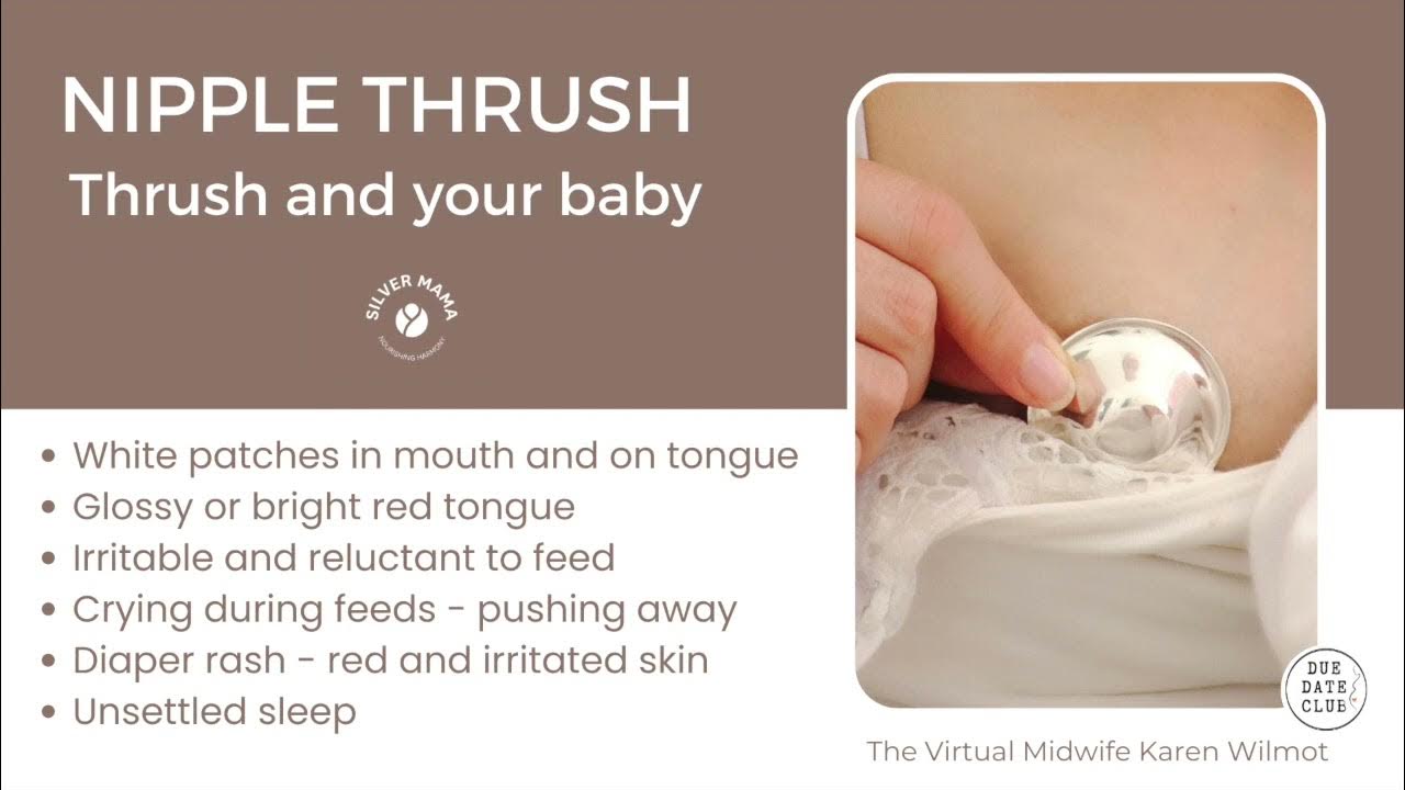 Breastfeeding Challenges Thrush YouTube