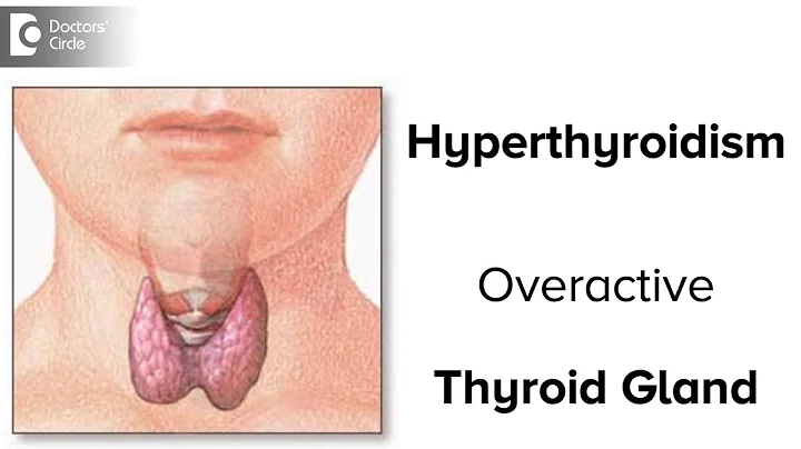 Hyperthyroidism | Overactive Thyroid Gland causes, signs, symptoms, treatment-Dr.Karthik Prabhakar - DayDayNews