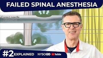 Failed Spinal Anesthesia Explained #2- Regional anesthesia Crash course with Dr. Hadzic