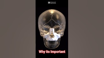 Maxilla Bone: Recessed or WIDE?