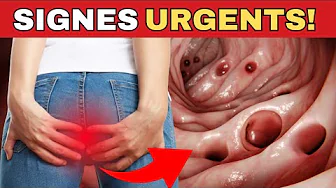 Cancer du côlon : 8 symptômes qui nécessitent un contrôle urgent !