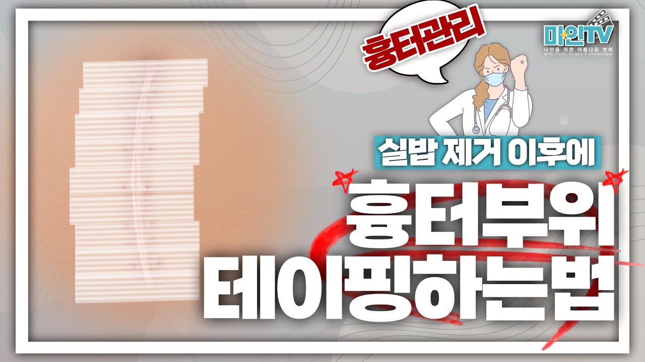 흉터 관리법ㅣ수술 후 흉터 부위 테이핑 하는 법✨ㅣ마인성형외과ㅣ환자주의사항ㅣ테이핑