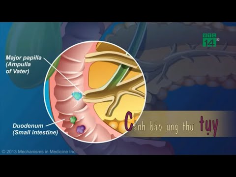 Video: Ung Thư Tuyến Tụy (Insulinoma) ở Chó