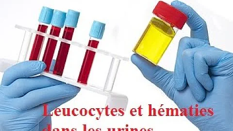 Quel est le taux normal d'hématies dans les urines ?